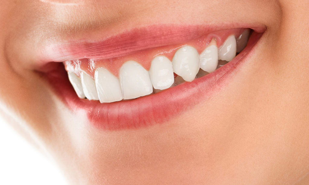 Periodontal Plastic Surgery North Charleston, SC