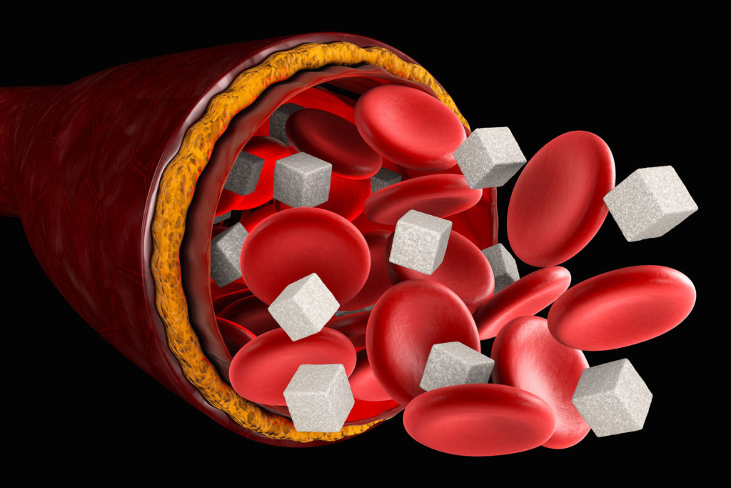 Blood sugar levels Frank Sparacino DDS North Charleston, SC